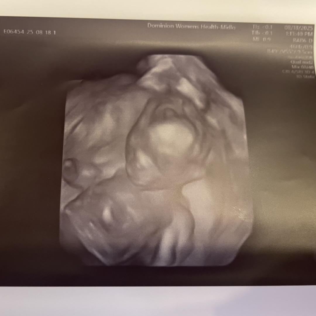 Photo shared by Emily for their Babylist baby registry.