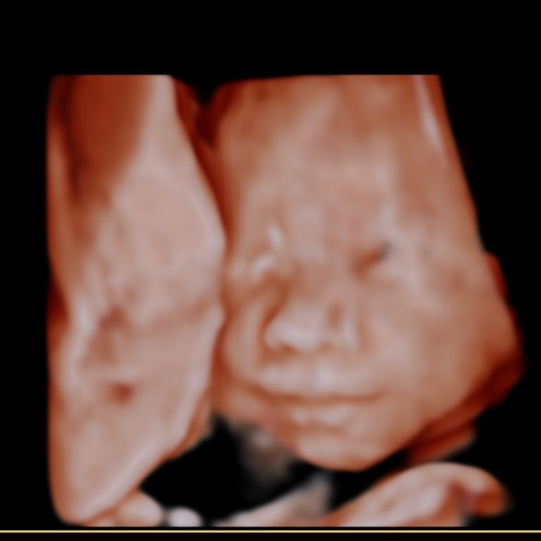 Photo shared by Sophia for their Babylist baby registry.