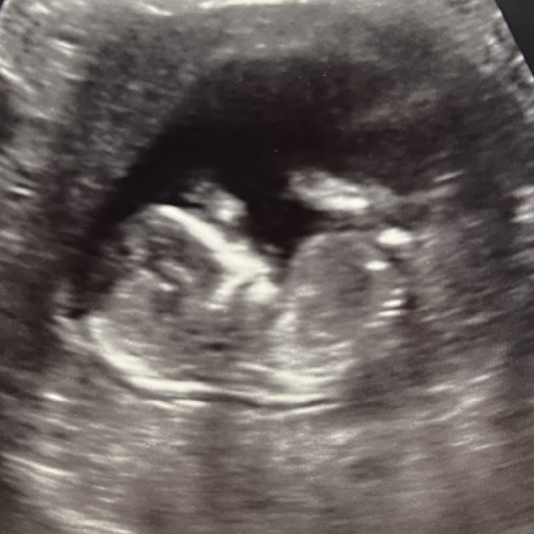 Photo shared by Sidney for their Babylist baby registry.