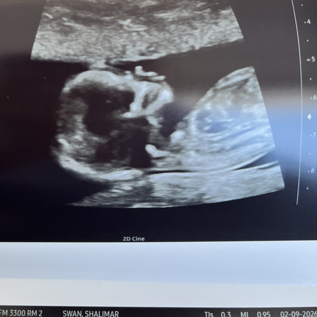 Photo shared by Shalimar for their Babylist baby registry.