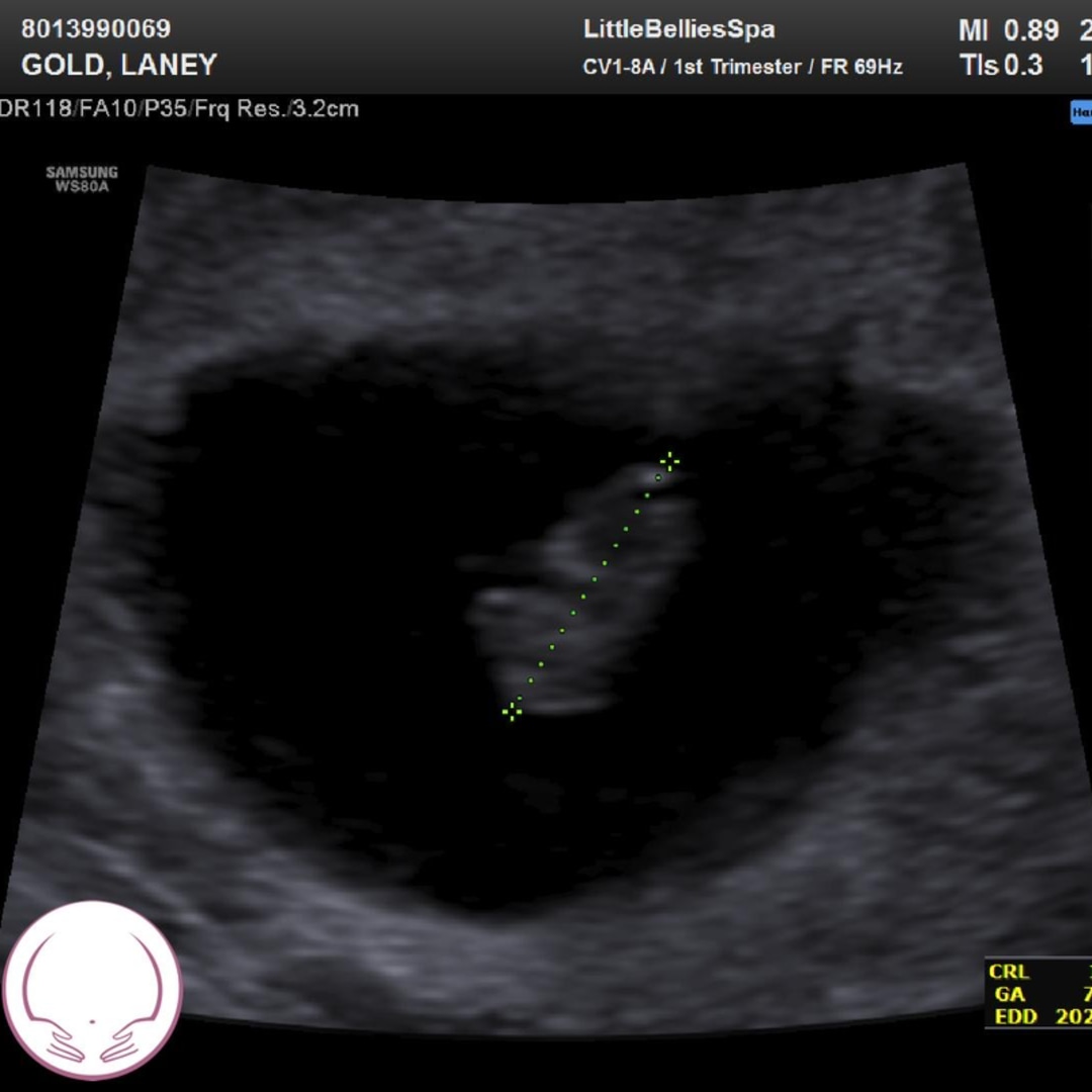 Photo shared by Laney for their Babylist baby registry.