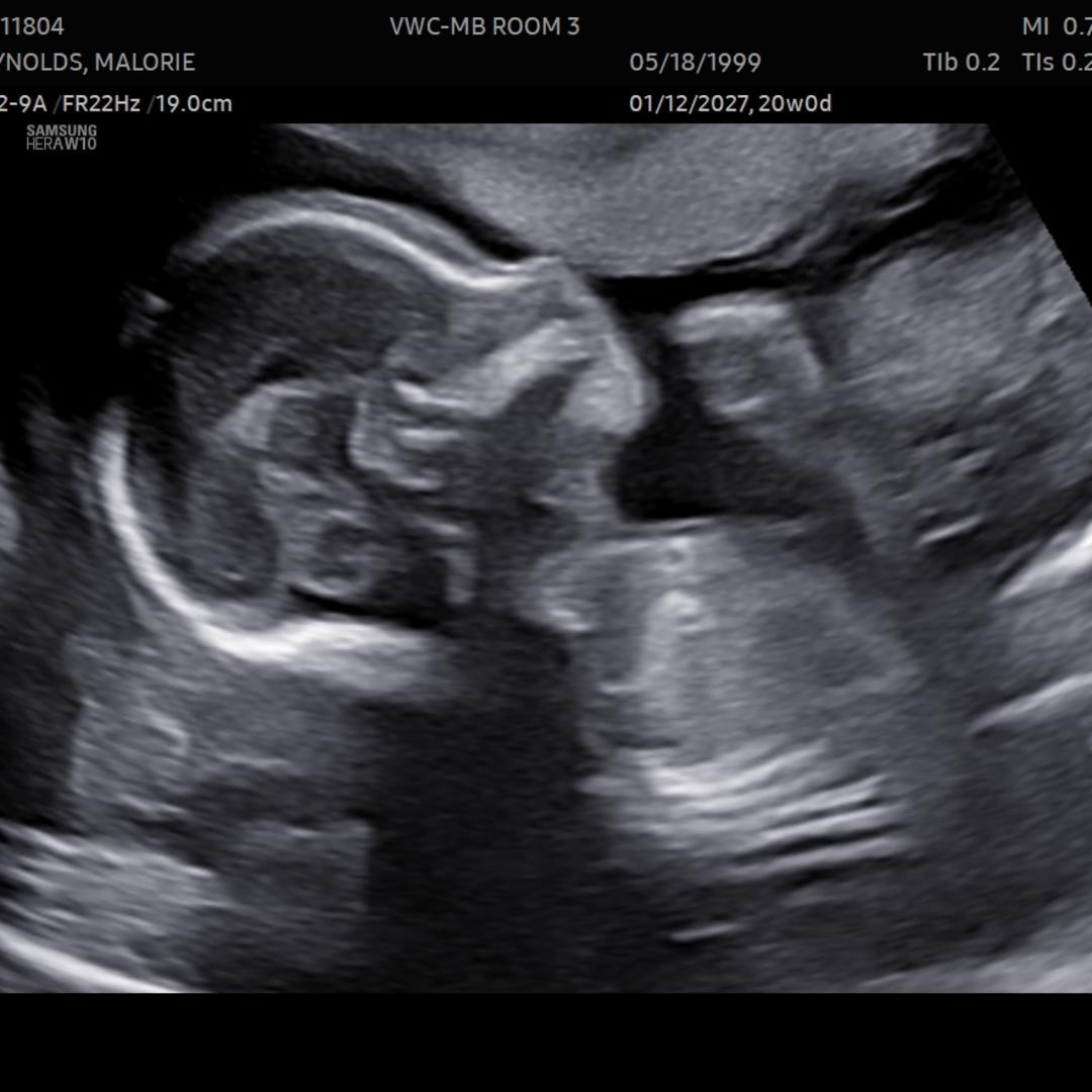 Photo shared by Malorie for their Babylist baby registry.