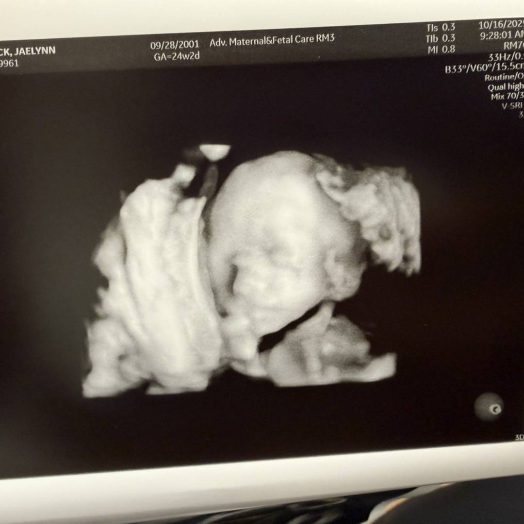 Photo shared by Jaelynn for their Babylist baby registry.