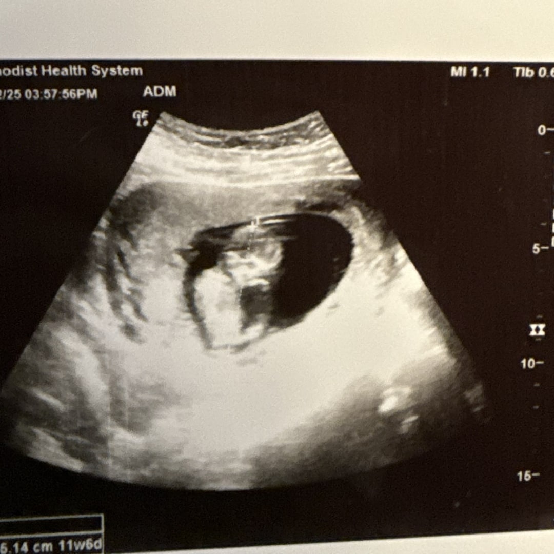 Photo shared by Maddison for their Babylist baby registry.