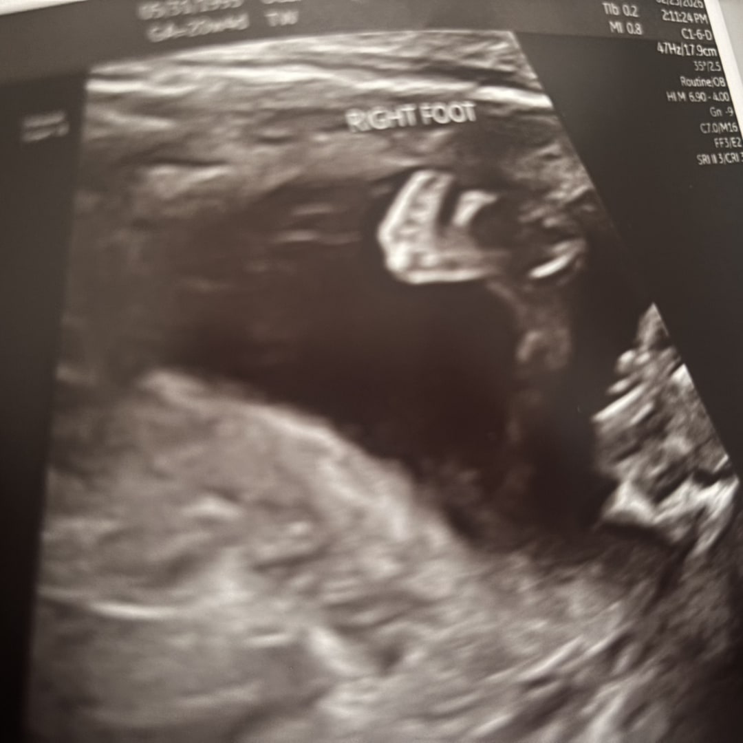 Photo shared by Nancy for their Babylist baby registry.