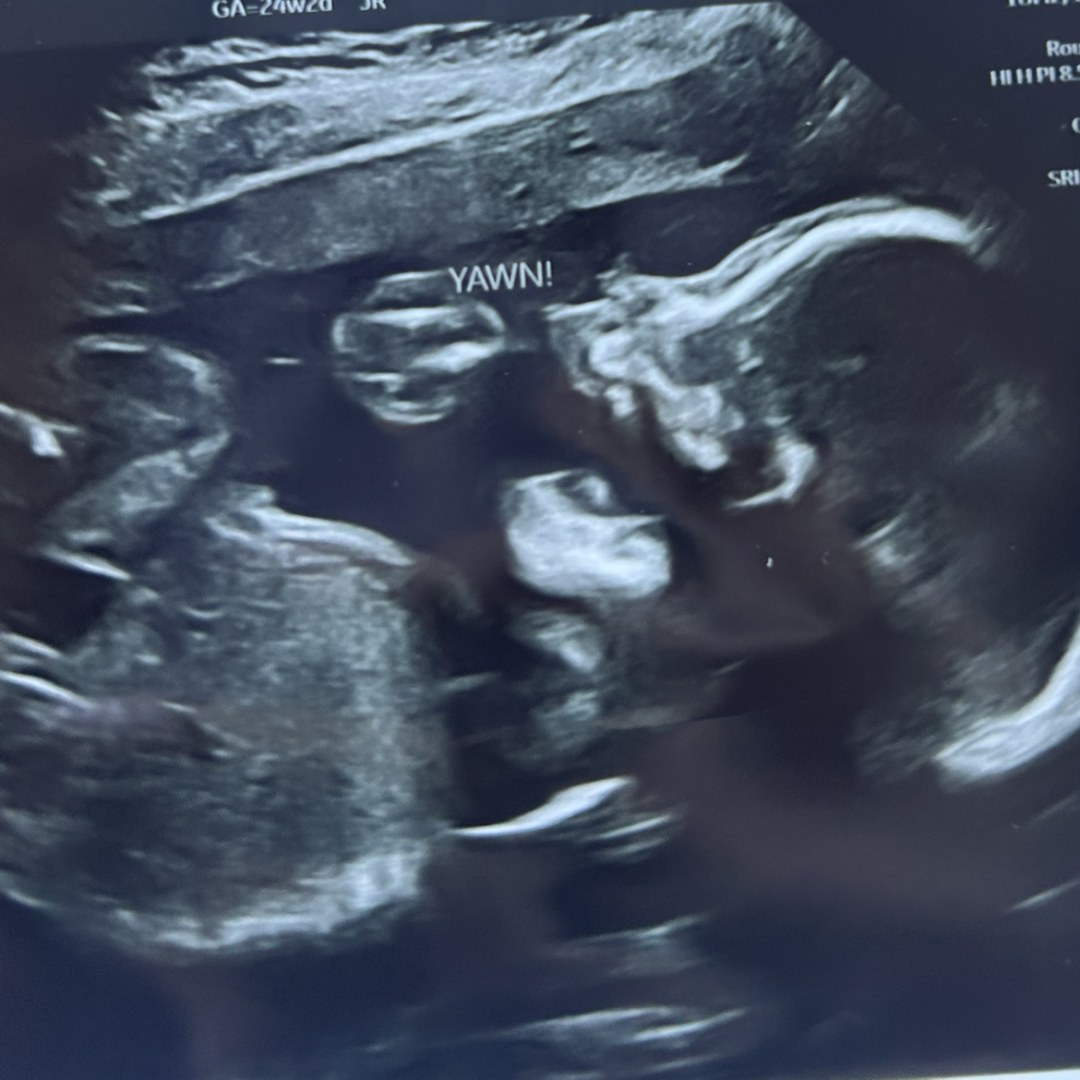 Photo shared by John for their Babylist baby registry.