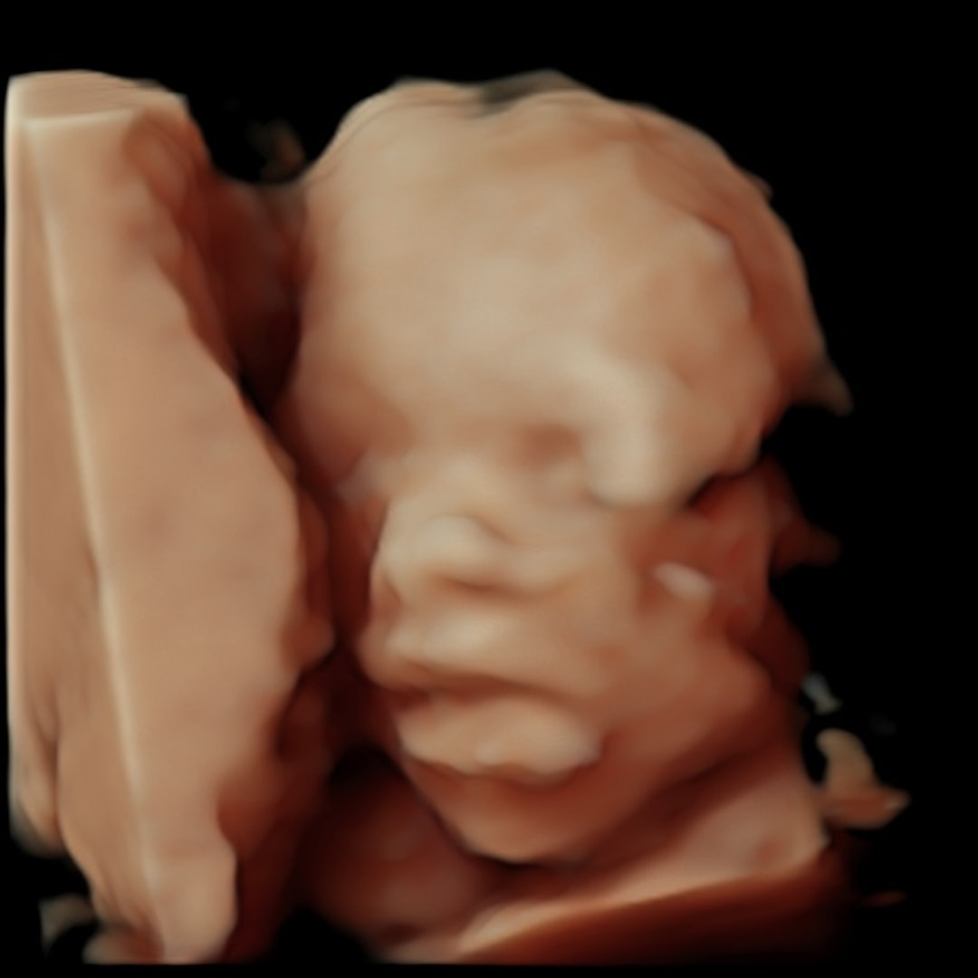 Photo shared by Shelby for their Babylist baby registry.