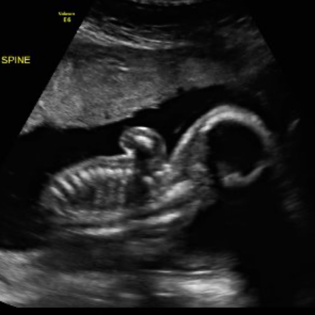 Photo shared by Kaitlyn for their Babylist baby registry.