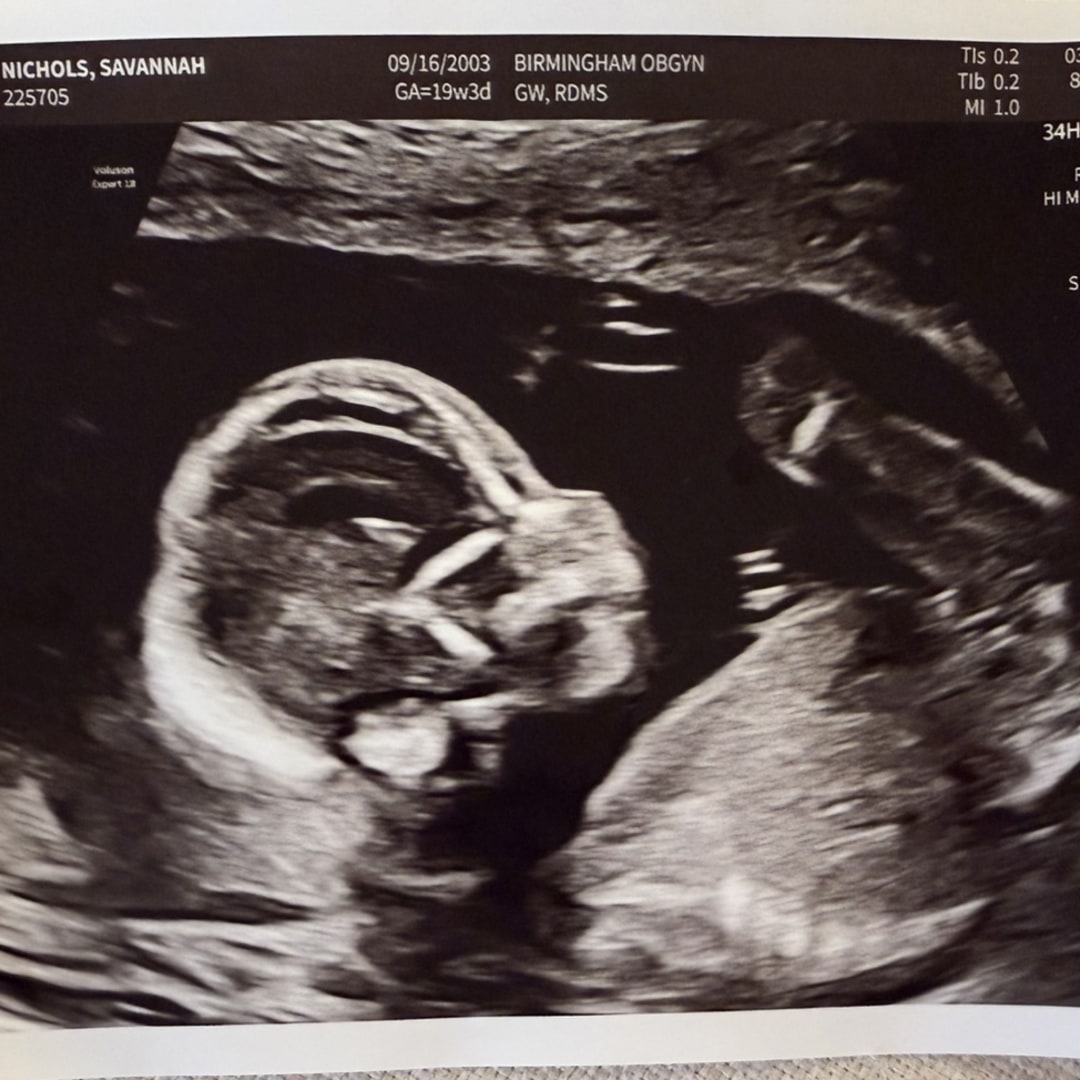 Photo shared by Savannah for their Babylist baby registry.