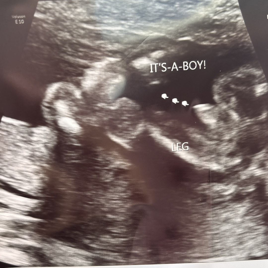 Photo shared by Chelseaann for their Babylist baby registry.