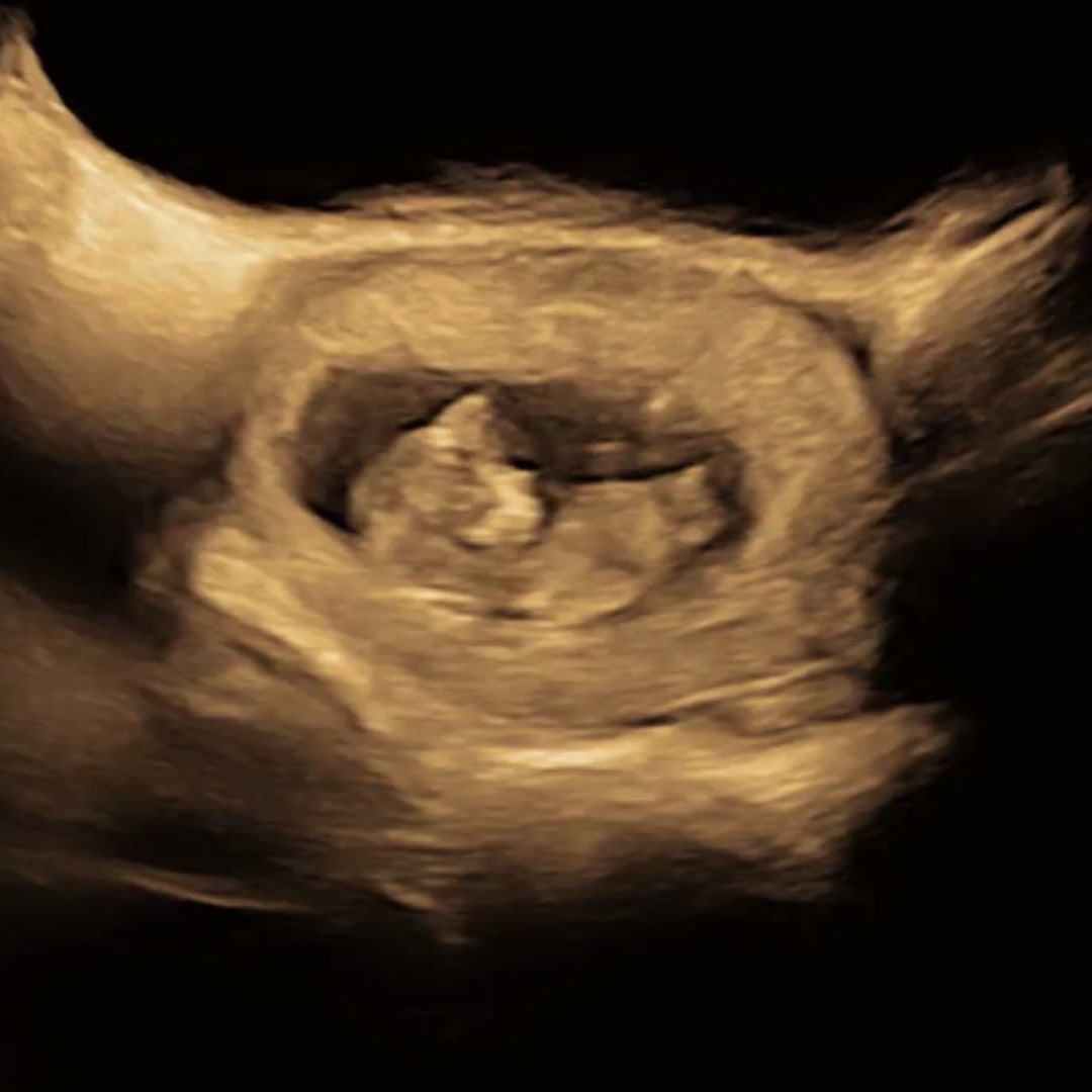 Photo shared by Julia for their Babylist baby registry.