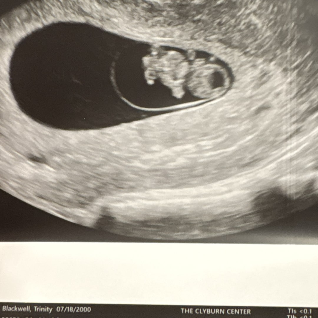 Photo shared by Trinity for their Babylist baby registry.