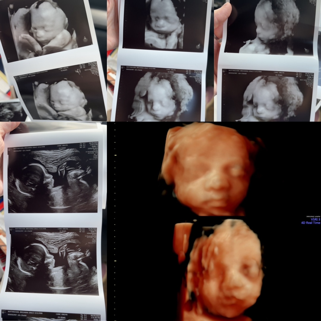 Photo shared by BreeAnna for their Babylist baby registry.