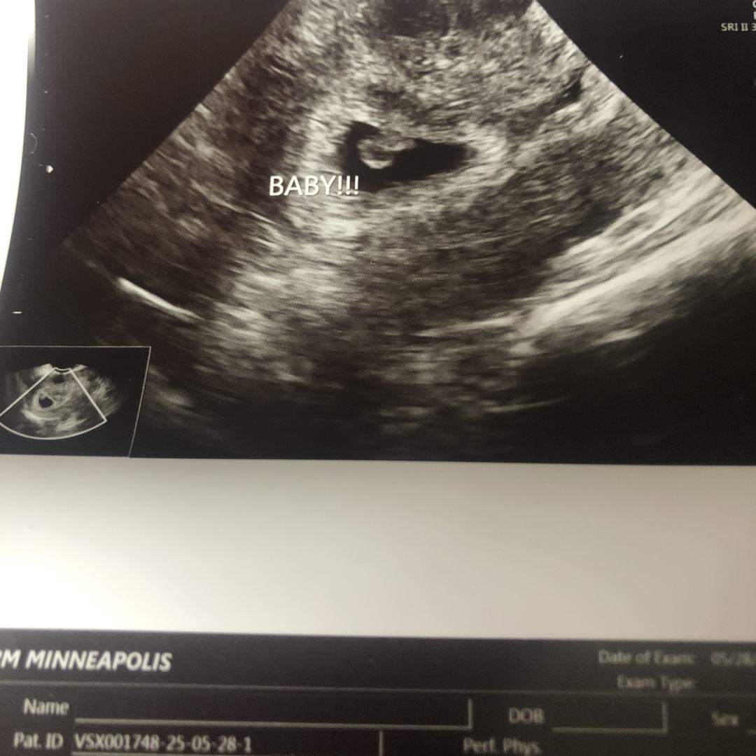 Photo shared by Michelle for their Babylist baby registry.