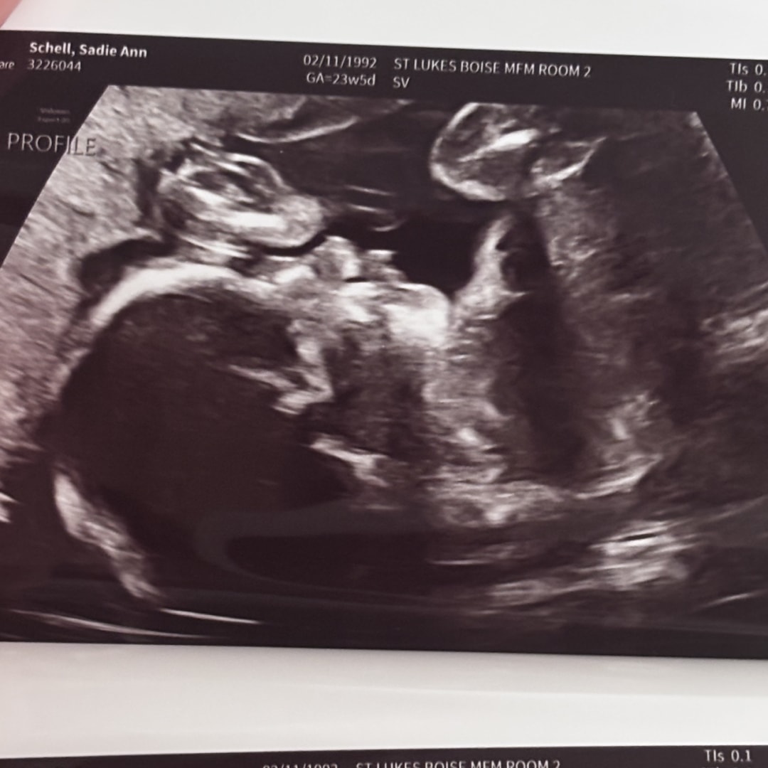 Photo shared by Sadie for their Babylist baby registry.