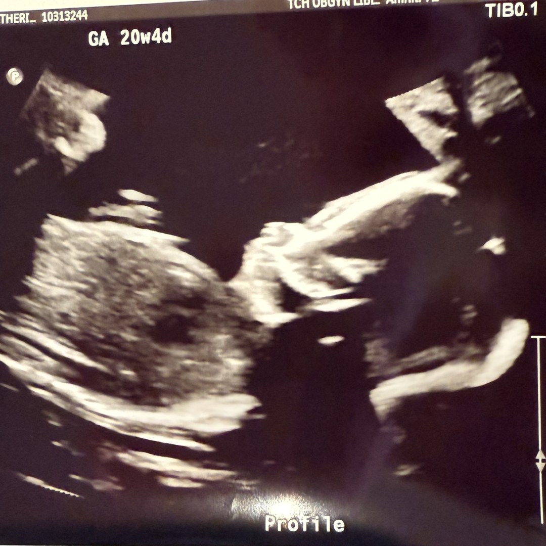 Photo shared by Kate for their Babylist baby registry.