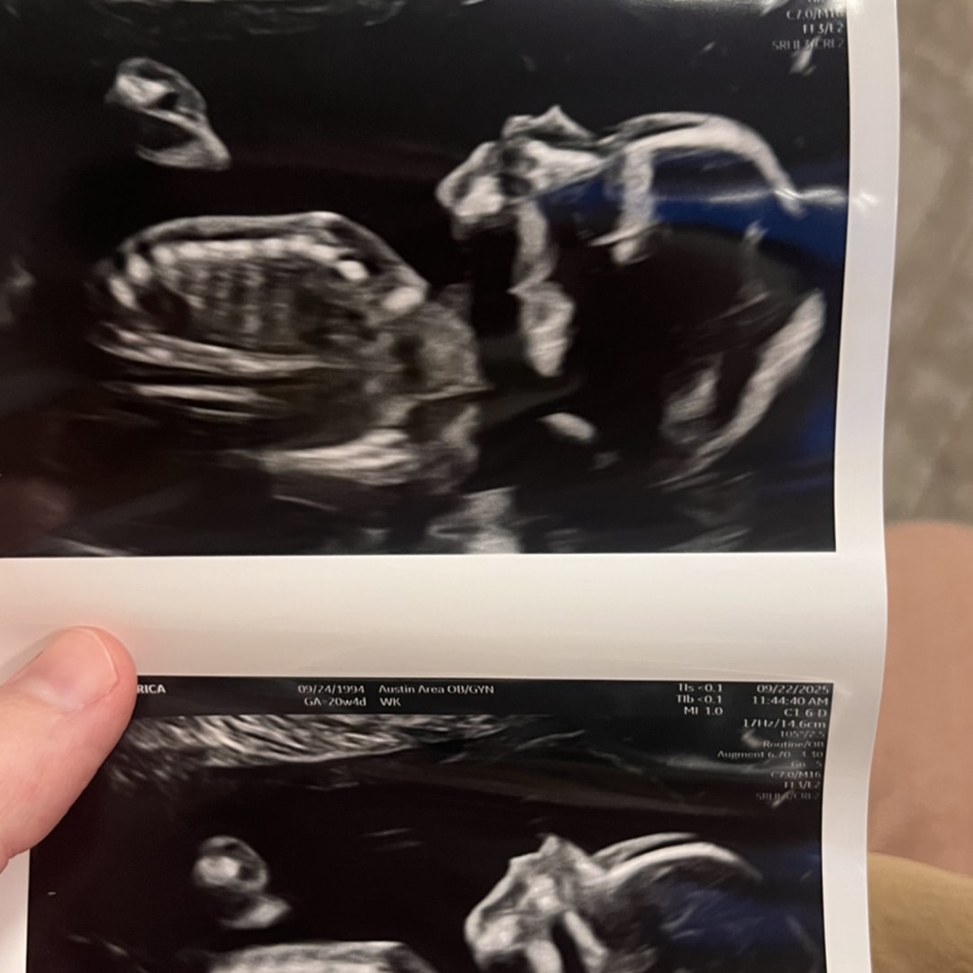 Photo shared by Erica for their Babylist baby registry.