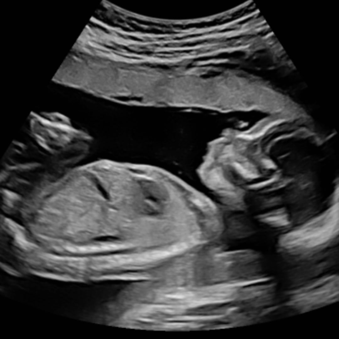 Photo shared by Alexis for their Babylist baby registry.