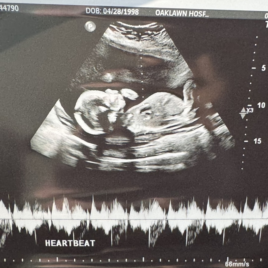 Photo shared by Alaina for their Babylist baby registry.