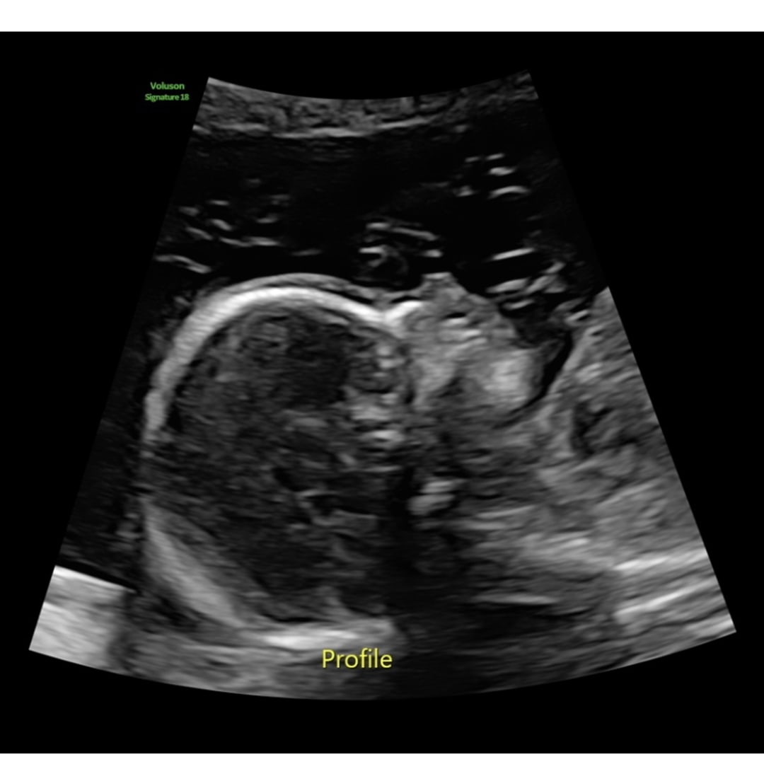 Photo shared by Ty'Nasia for their Babylist baby registry.