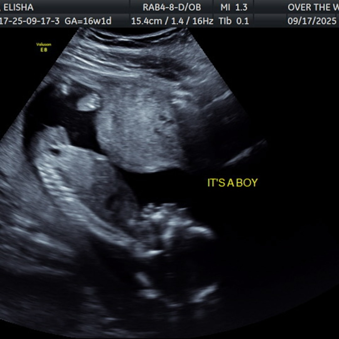 Photo shared by Elisha for their Babylist baby registry.