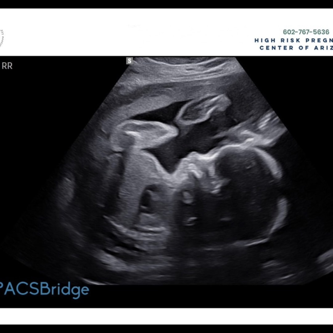 Photo shared by Adriana for their Babylist baby registry.
