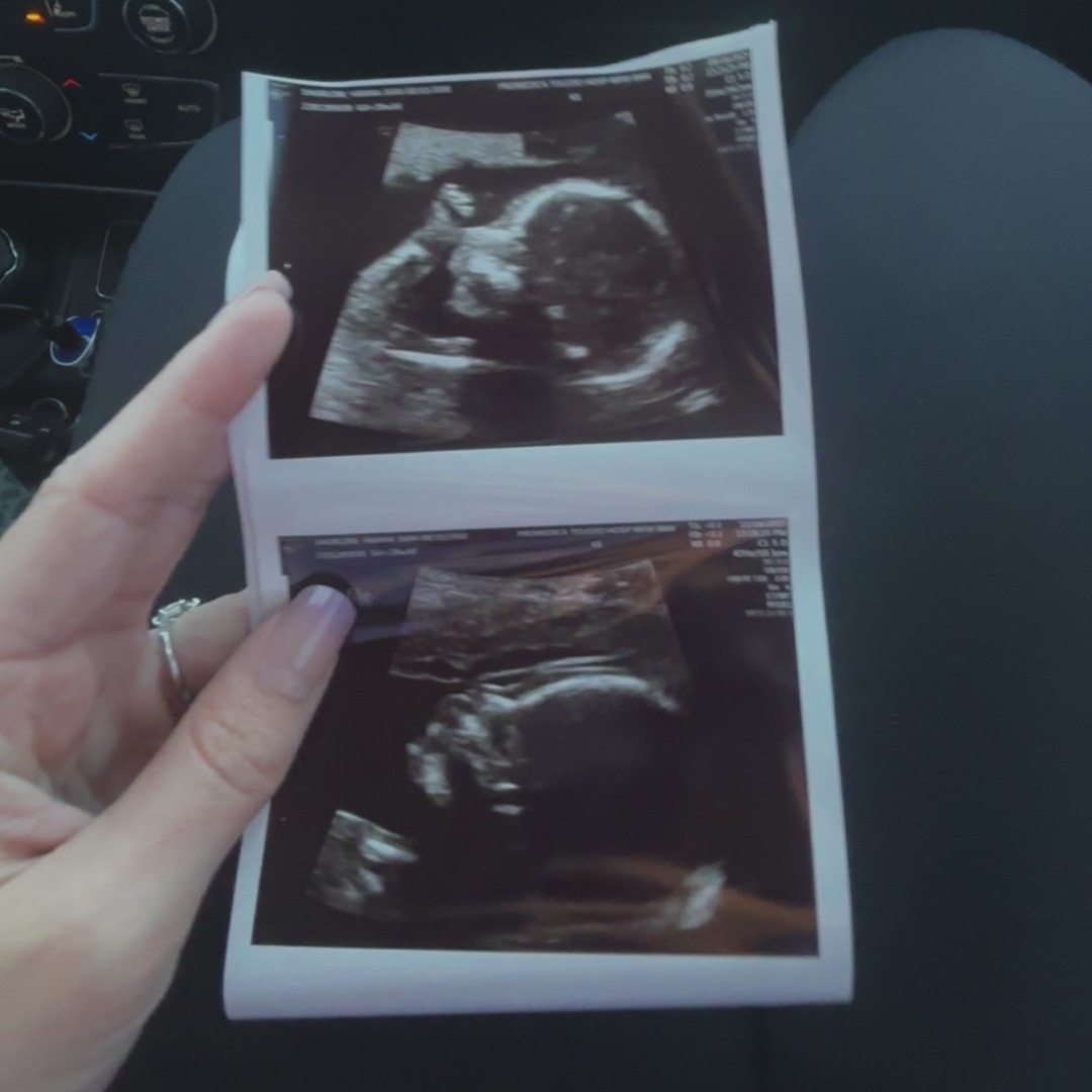 Photo shared by Hanna for their Babylist baby registry.