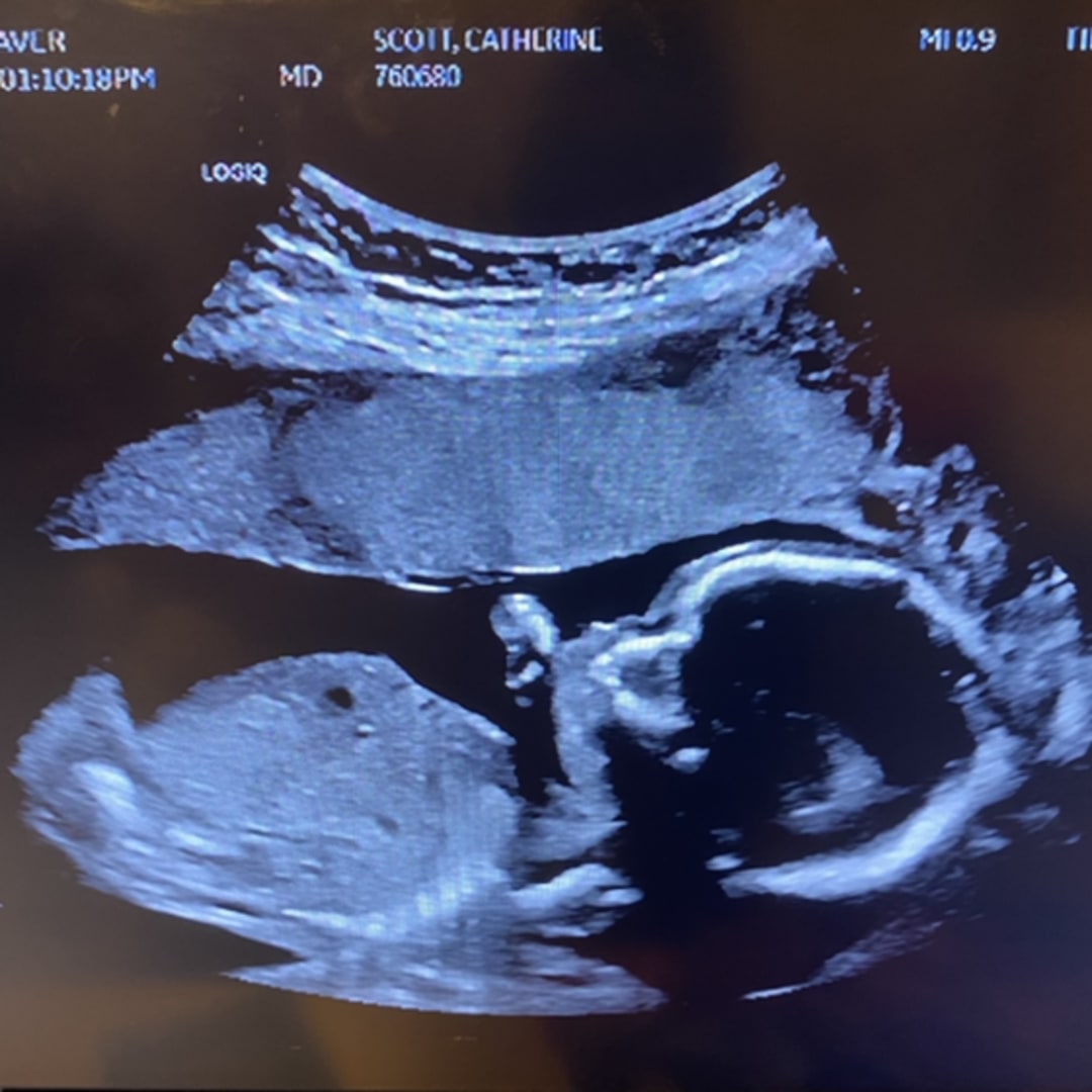 Photo shared by Katie for their Babylist baby registry.
