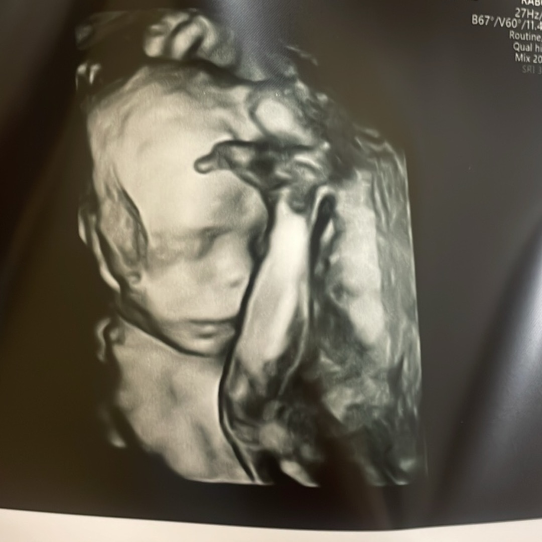 Photo shared by Karly for their Babylist baby registry.