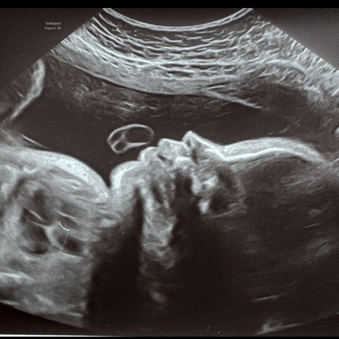 Photo shared by Brii for their Babylist baby registry.