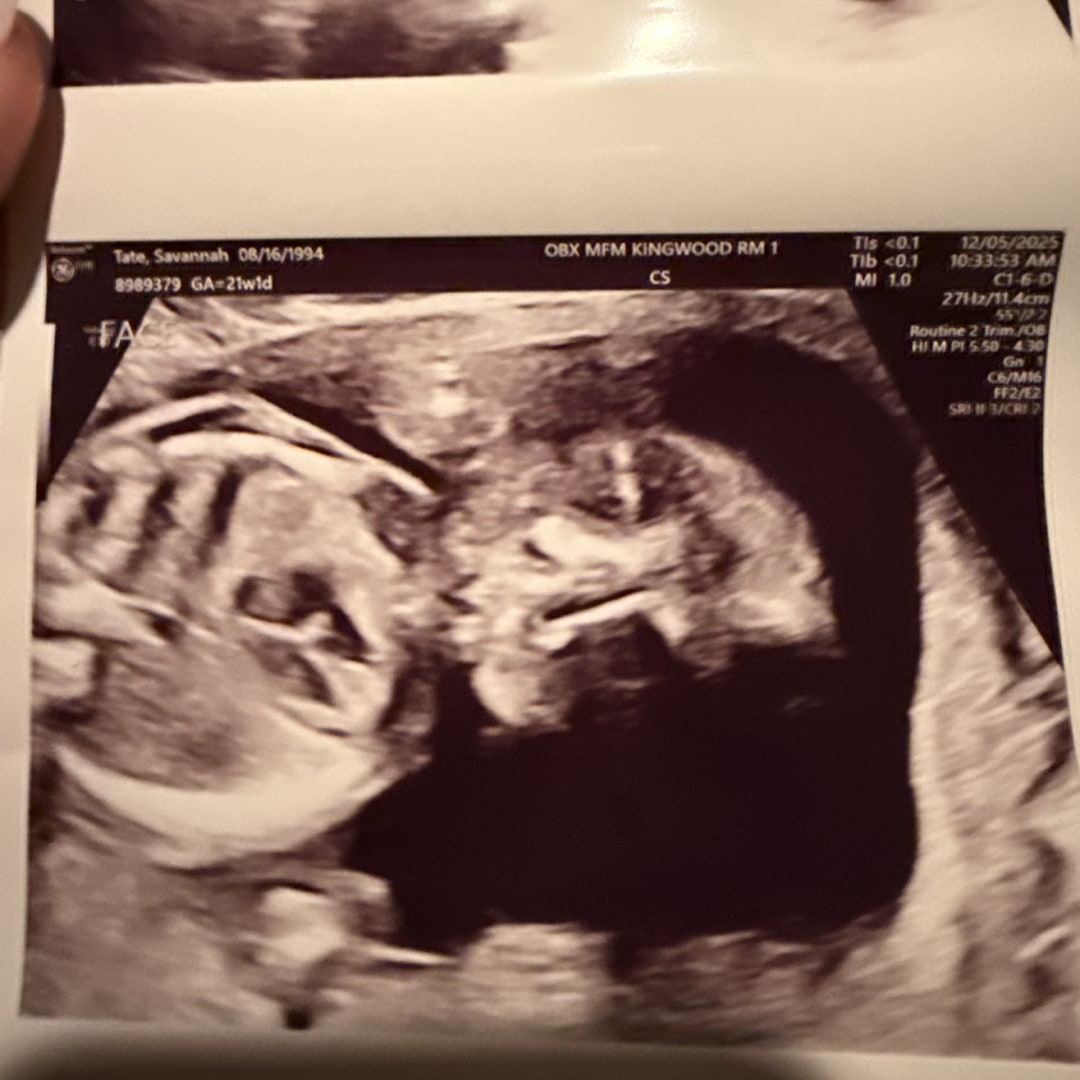 Photo shared by Savannah for their Babylist baby registry.