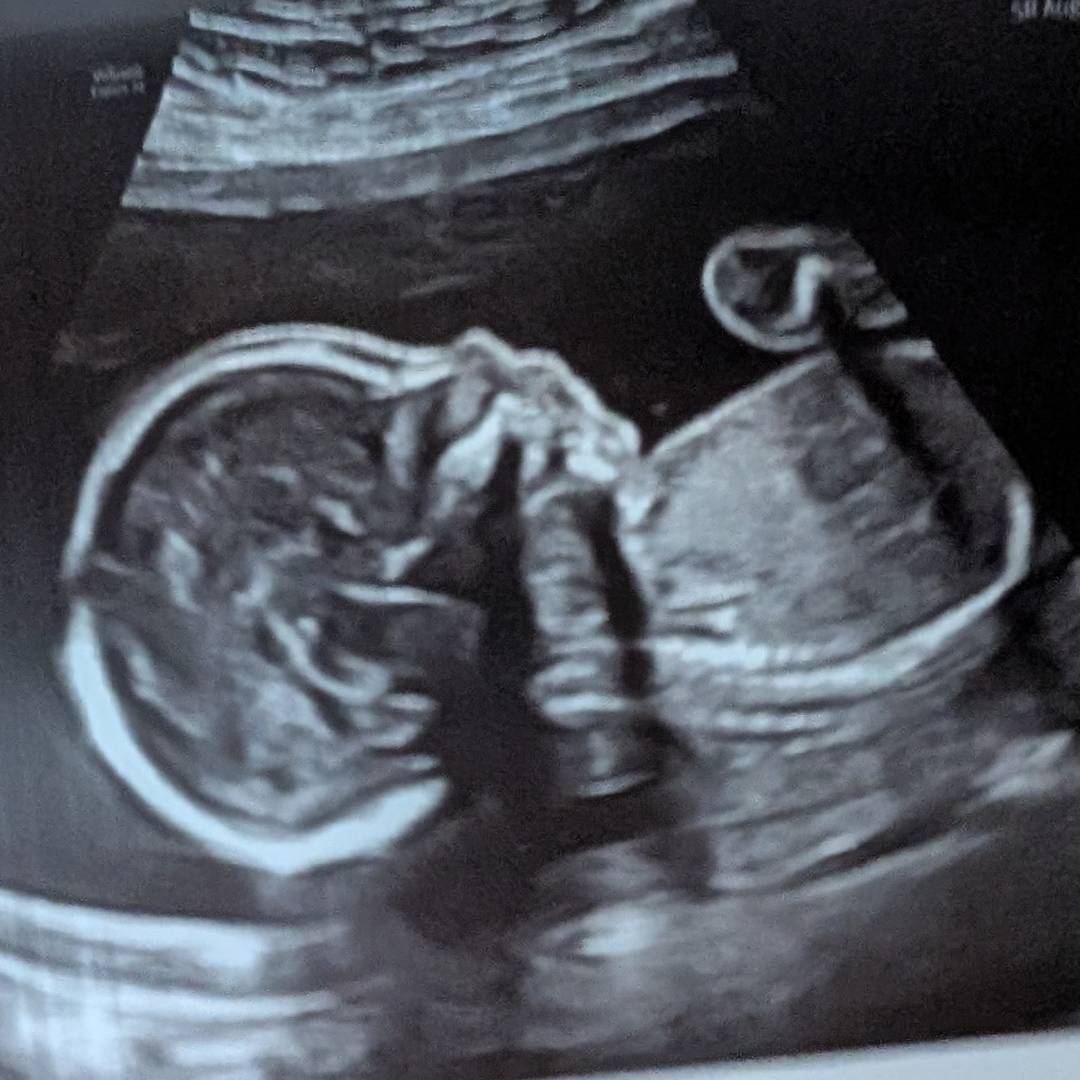 Photo shared by Spencer for their Babylist baby registry.