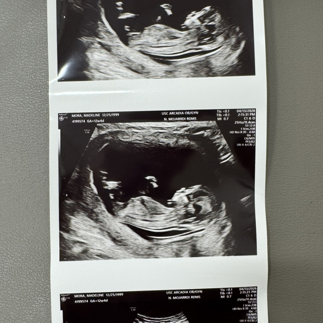 Photo shared by Madeline for their Babylist baby registry.