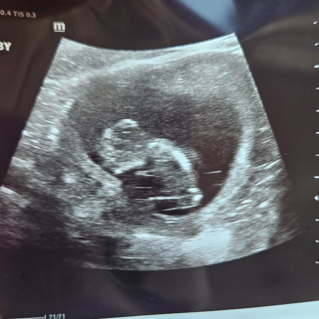 Photo shared by Kelly for their Babylist baby registry.