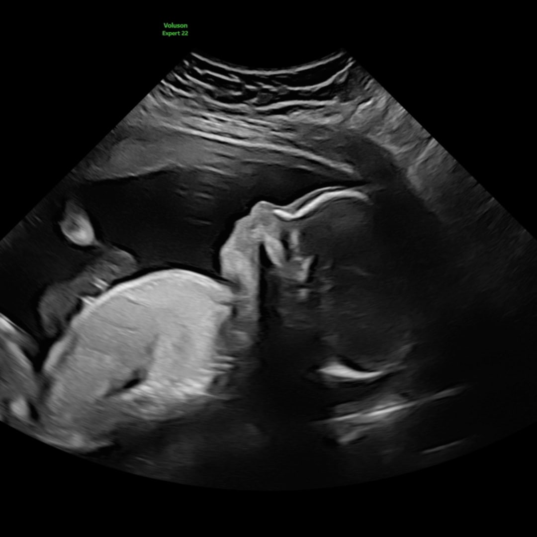Photo shared by Jadyn for their Babylist baby registry.