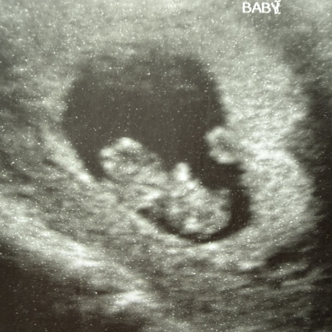 Photo shared by Mary Grace for their Babylist baby registry.