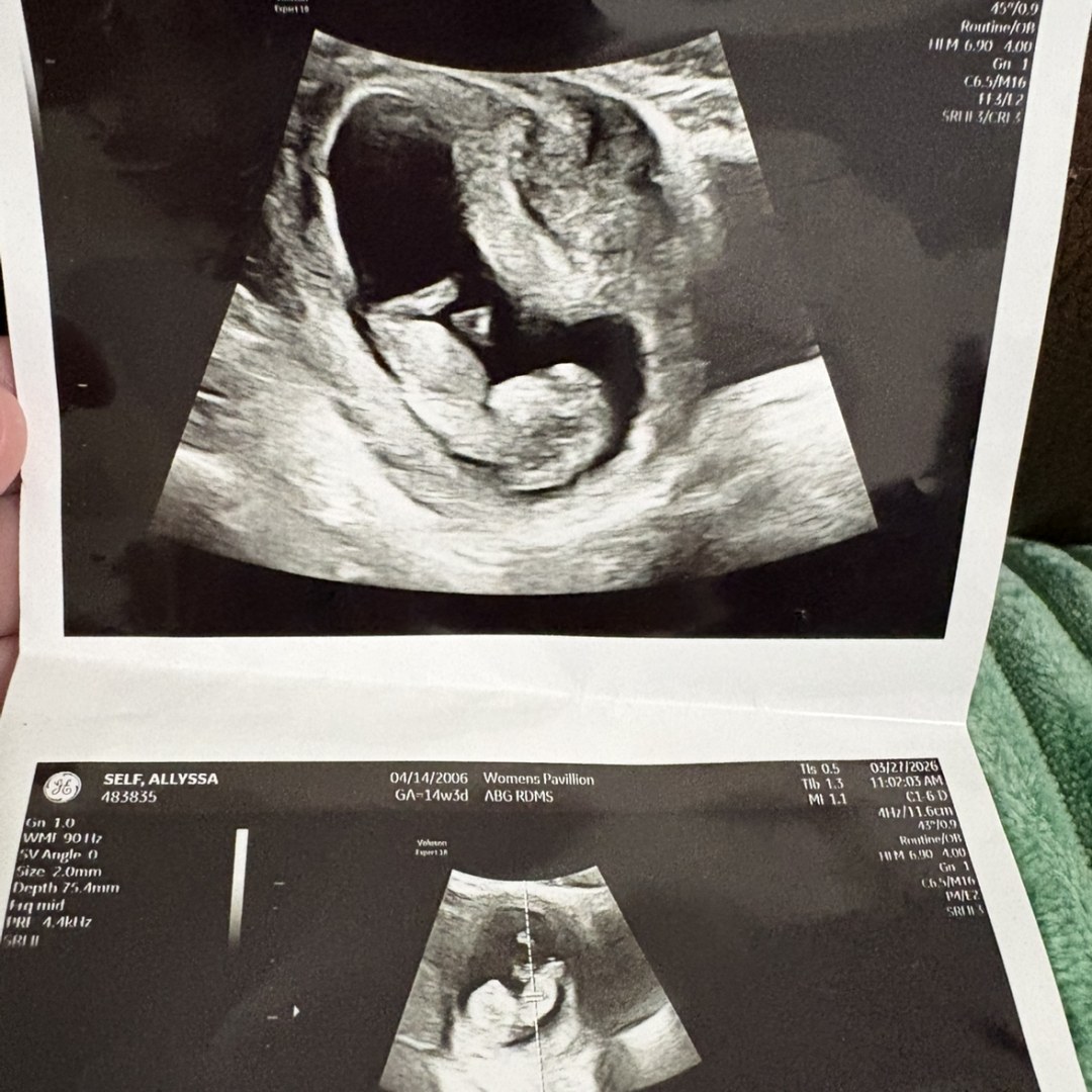 Photo shared by Allyssa for their Babylist baby registry.