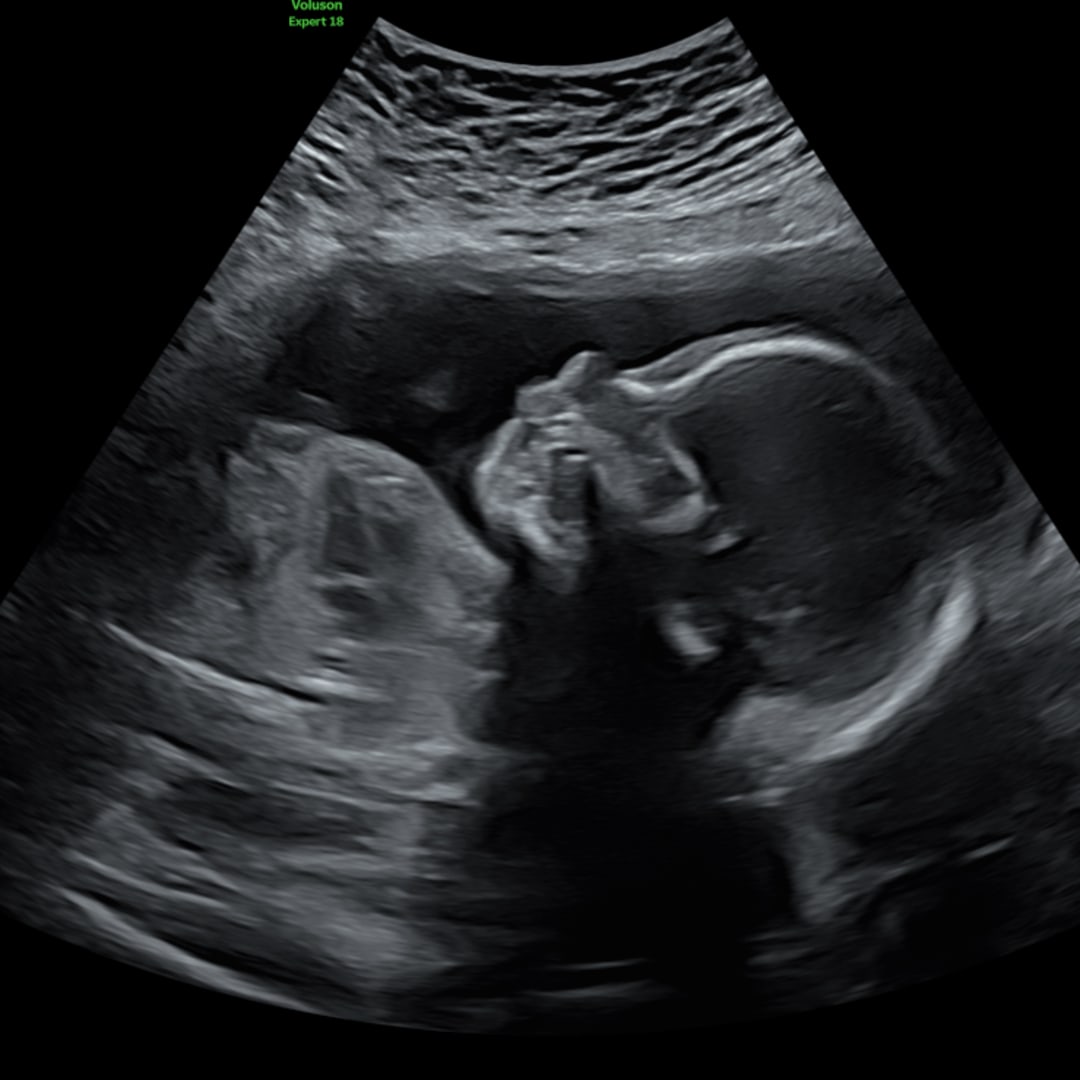 Photo shared by Paige for their Babylist baby registry.
