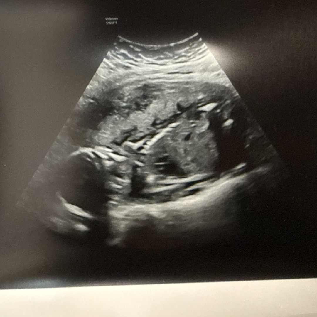 Photo shared by Jenna for their Babylist baby registry.