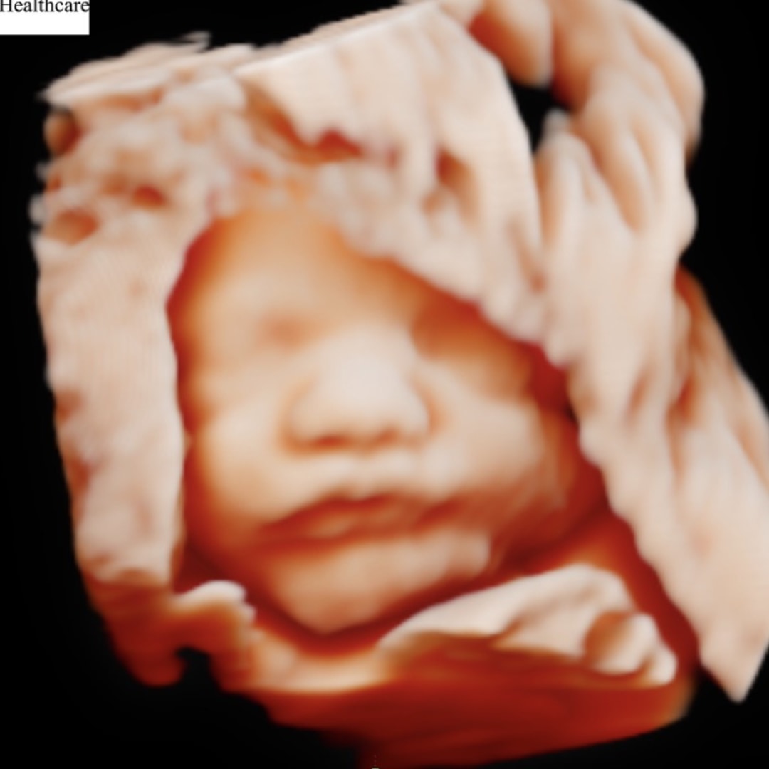 Photo shared by Abby for their Babylist baby registry.