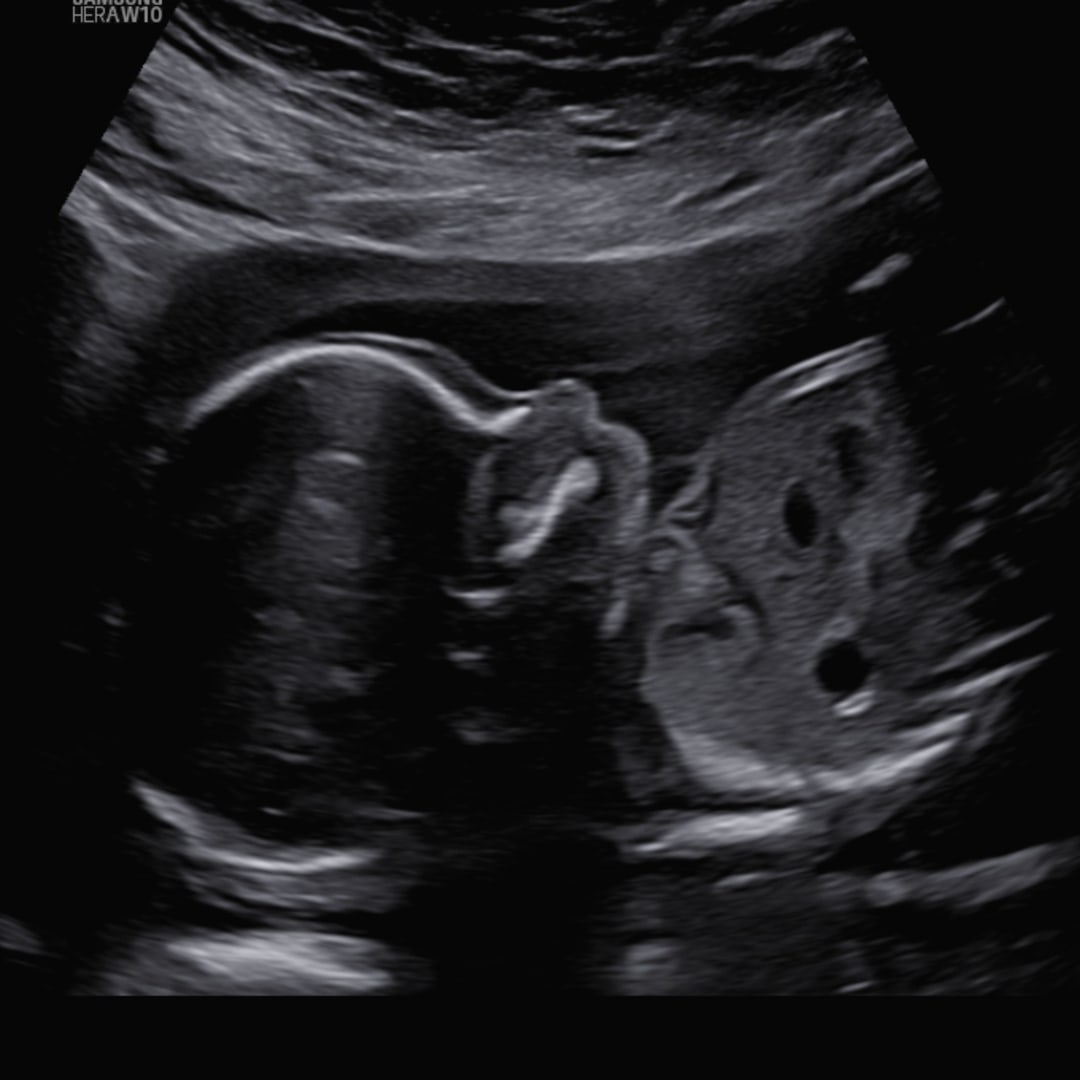Photo shared by Andrea for their Babylist baby registry.