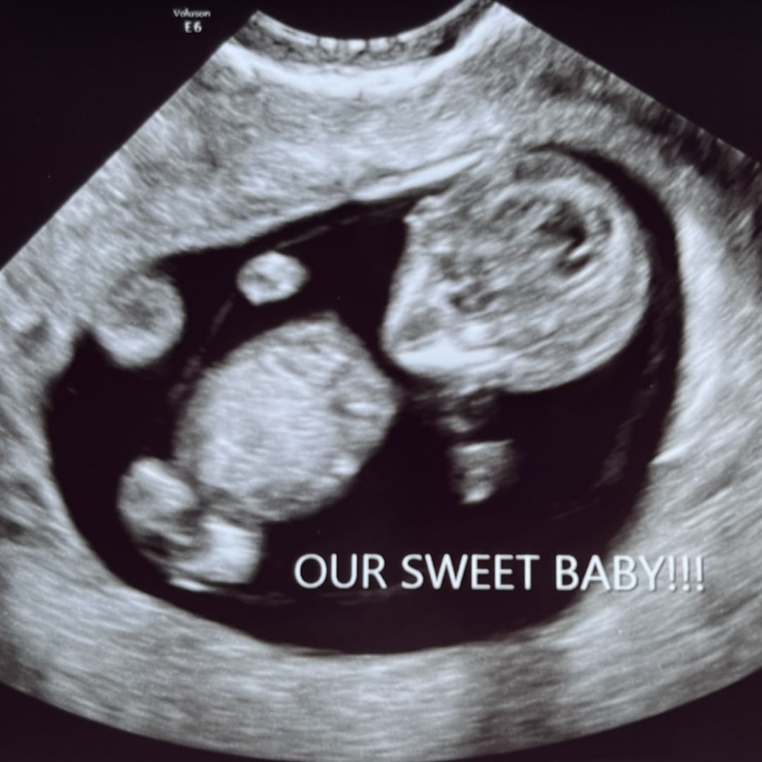 Photo shared by Anna for their Babylist baby registry.