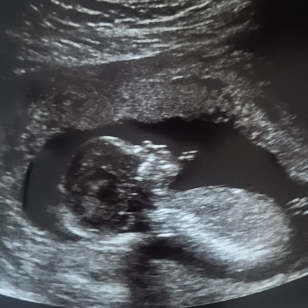 Photo shared by Jalynn for their Babylist baby registry.