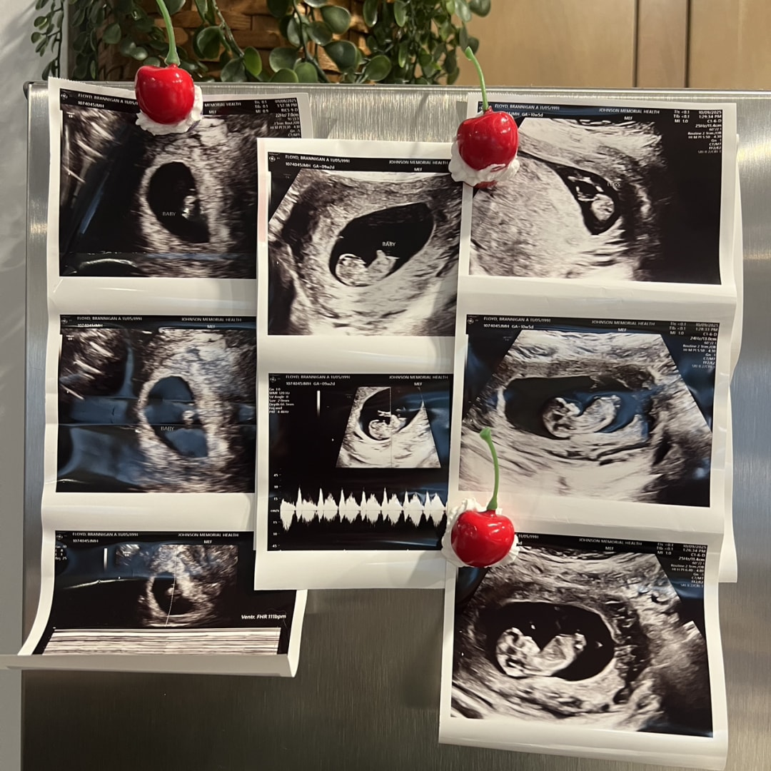 Photo shared by Brannigan for their Babylist baby registry.