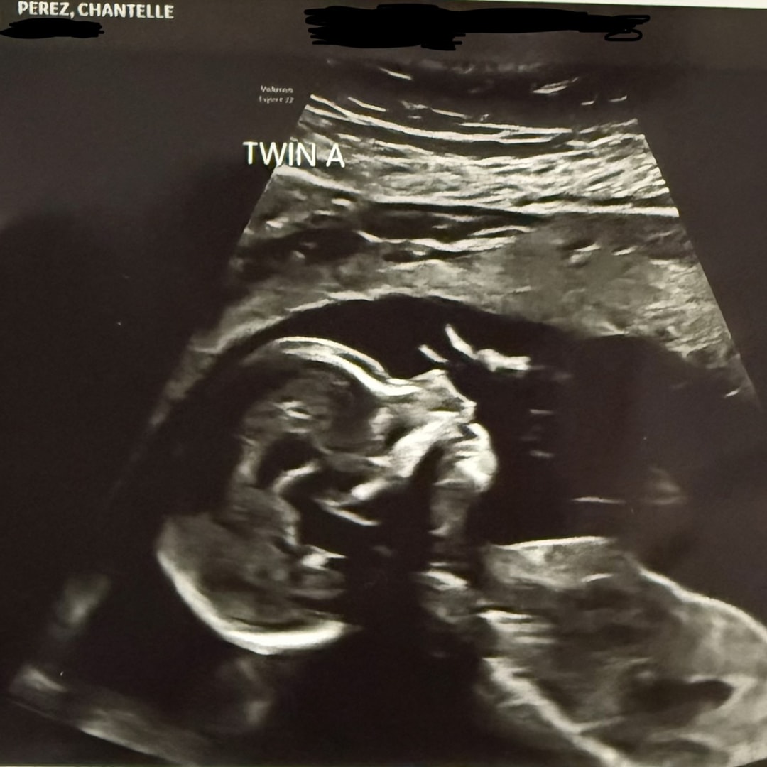 Photo shared by Chantelle for their Babylist baby registry.