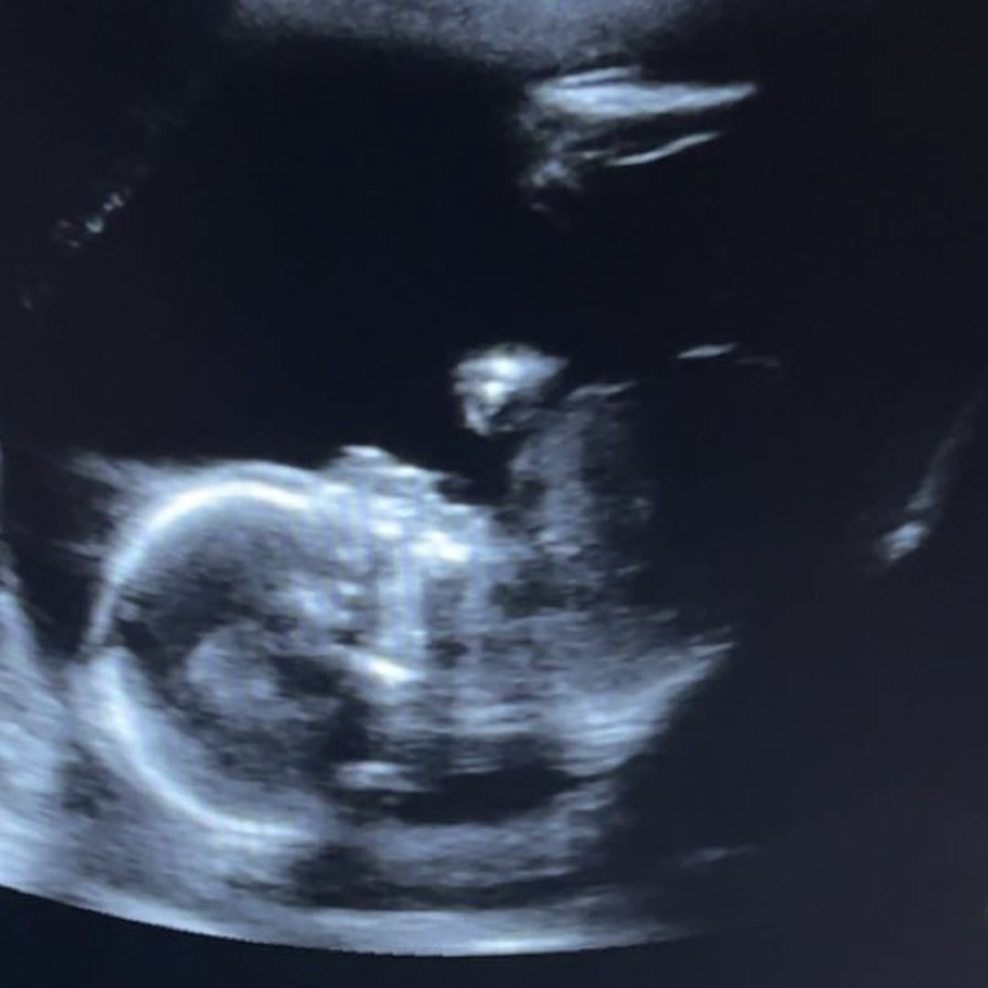 Photo shared by Karin for their Babylist baby registry.