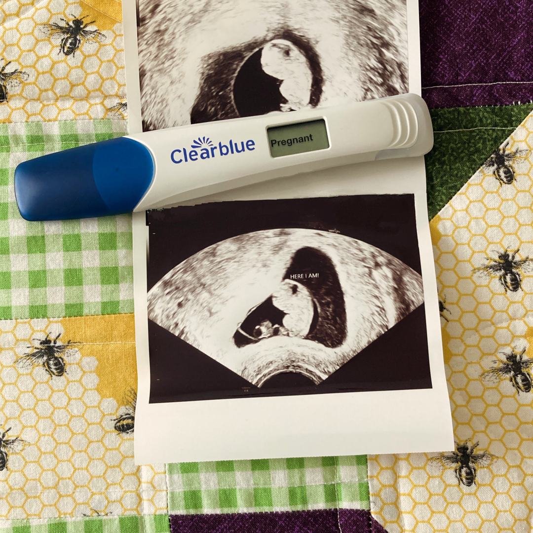 Photo shared by Evelyn for their Babylist baby registry.