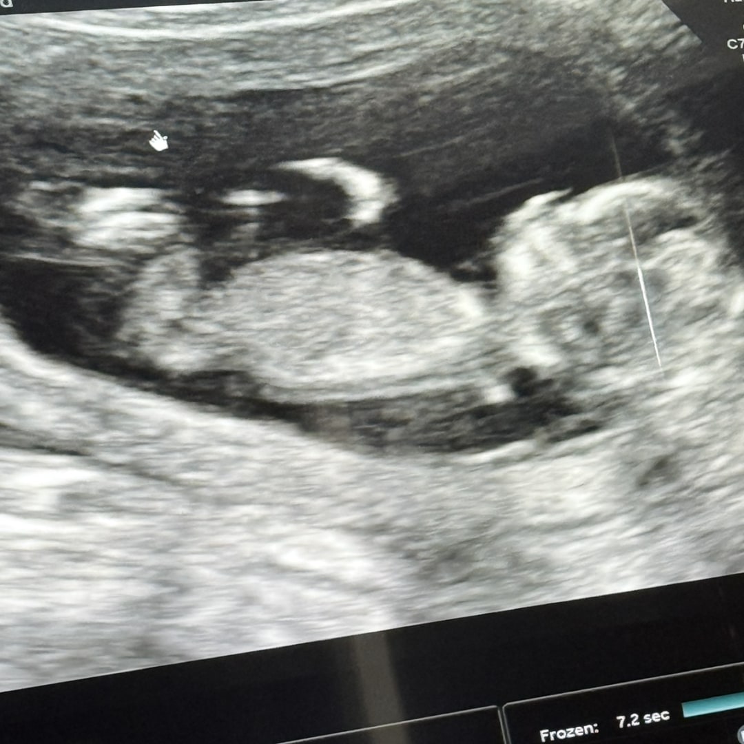 Photo shared by Vanessa for their Babylist baby registry.