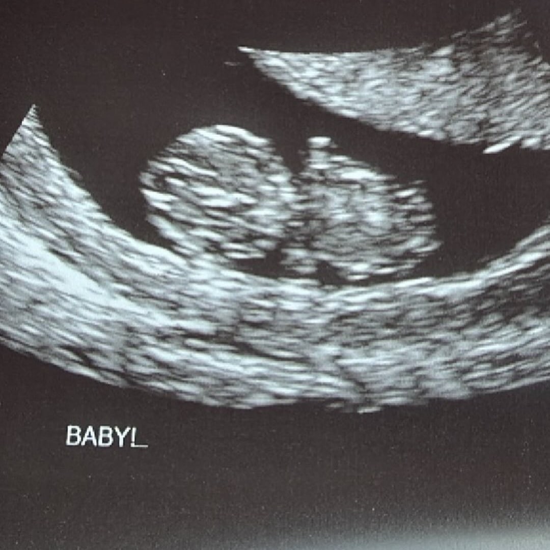Photo shared by Kami for their Babylist baby registry.