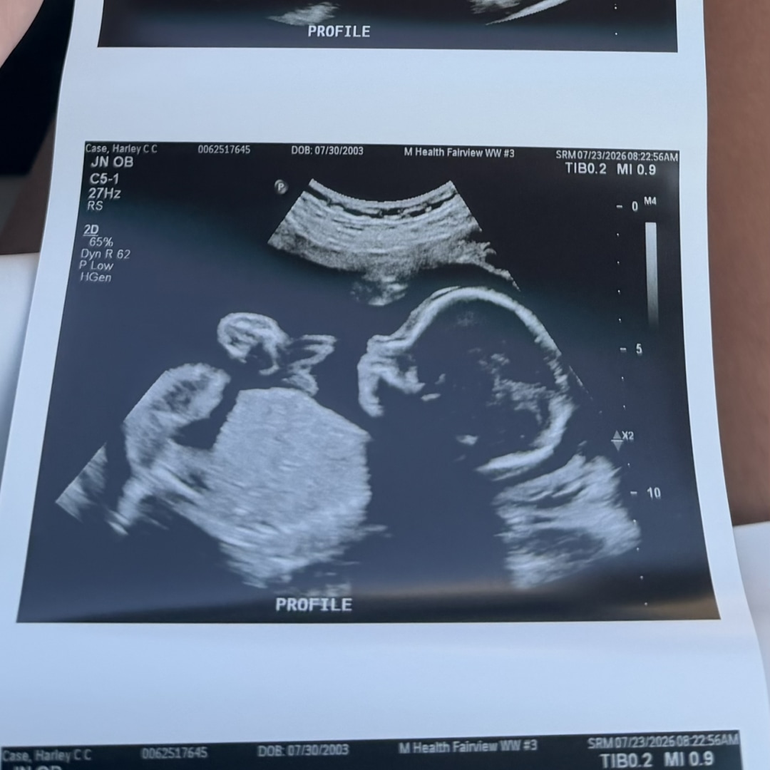 Photo shared by Harley for their Babylist baby registry.